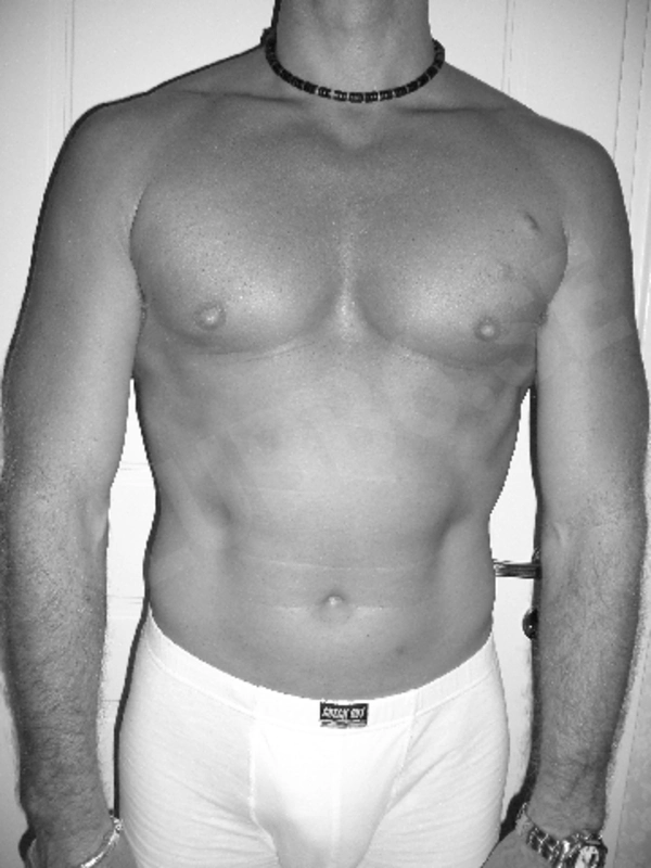 bimfos4008065